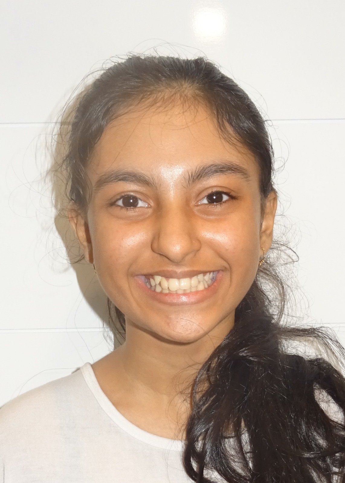 Invisalign before and after results Mumbai