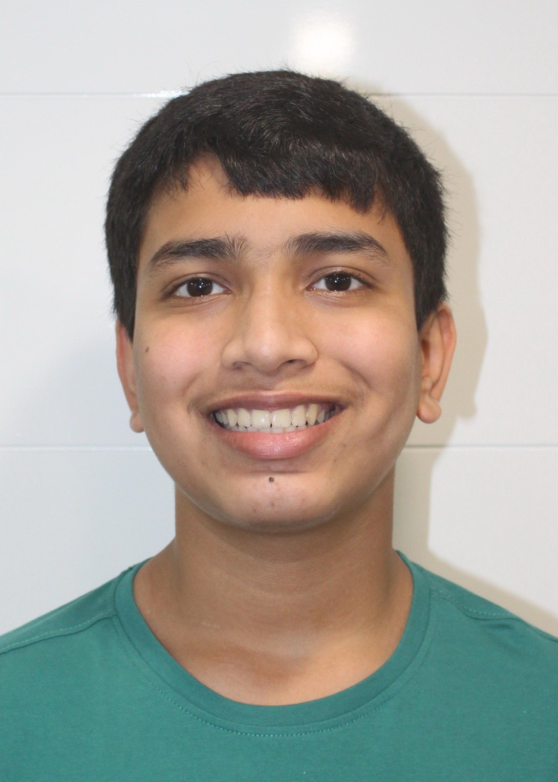 Invisalign before and after results Mumbai